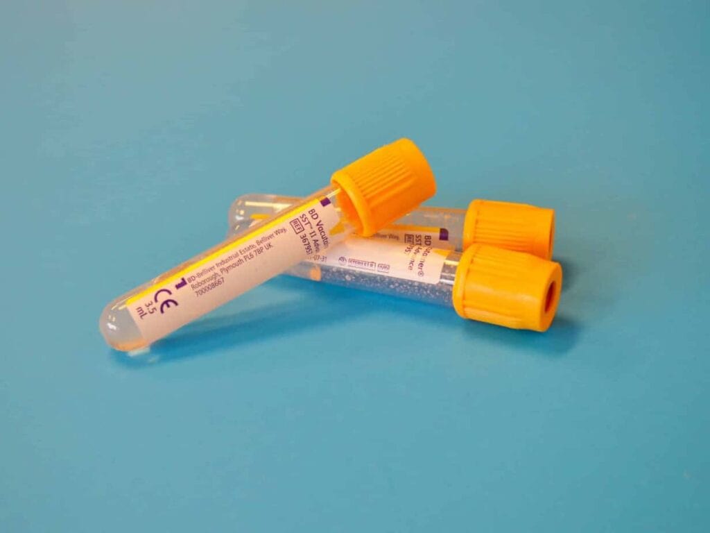 Delta-8 Before A Drug Test? — Does Delta-8 THC Mess Up A Standard Marijuana Screening? 