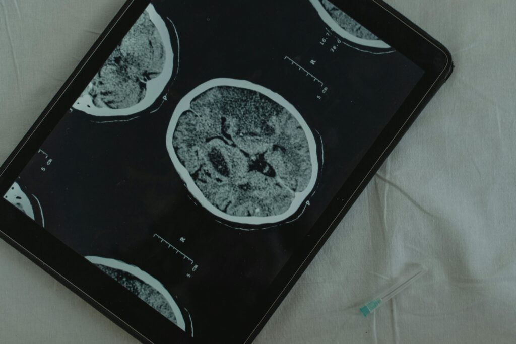 Understanding the Functionality and Implications of the CB2 Receptor