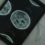 Understanding the Functionality and Implications of the CB2 Receptor
